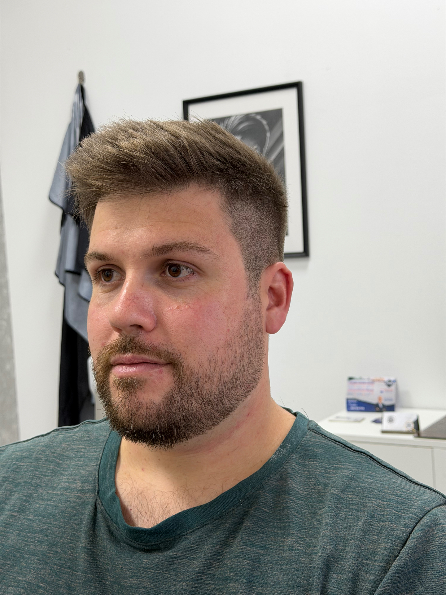 Transformação corte e barba — Depois